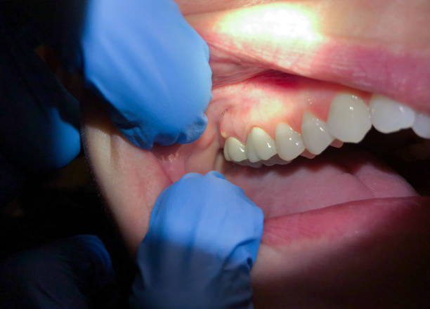 Best Emergency Broken Tooth Repair in Sand Ridge, NY